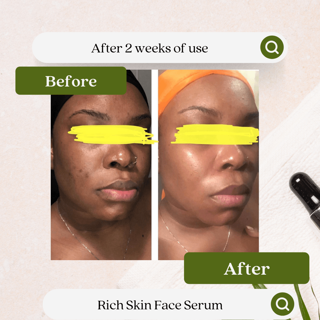 Rich Skin Face Serum - She Biology Skincare