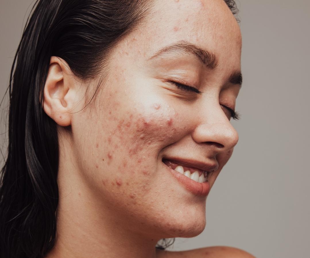 Empowering Radiance: Nurturing Your Skin Symphony with She Biology's Repair Hemp Retinol Face Cream