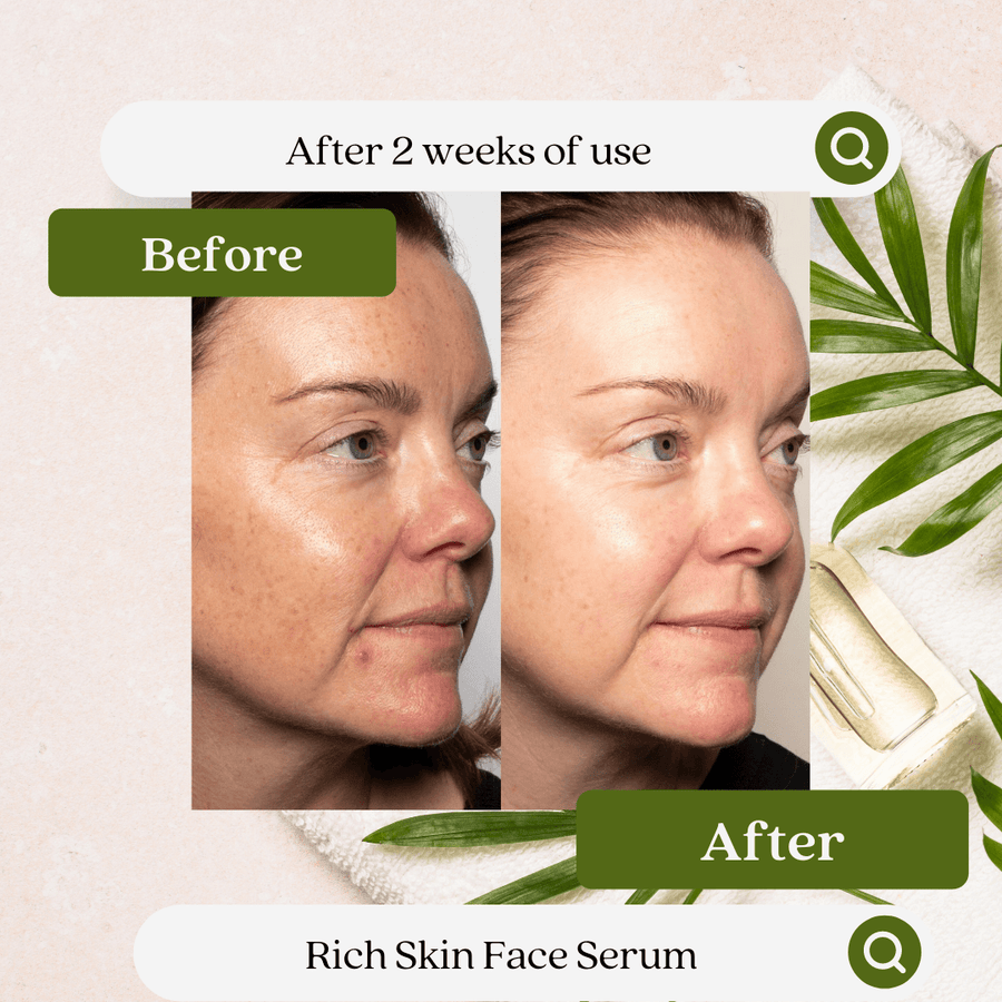 Rich Skin Face Serum - She Biology Skincare